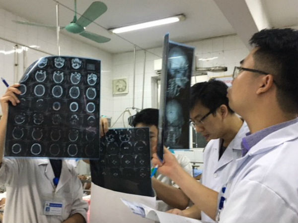 Uống an cung ngừa đột quỵ, một bệnh nhân xuất huyết toàn thân