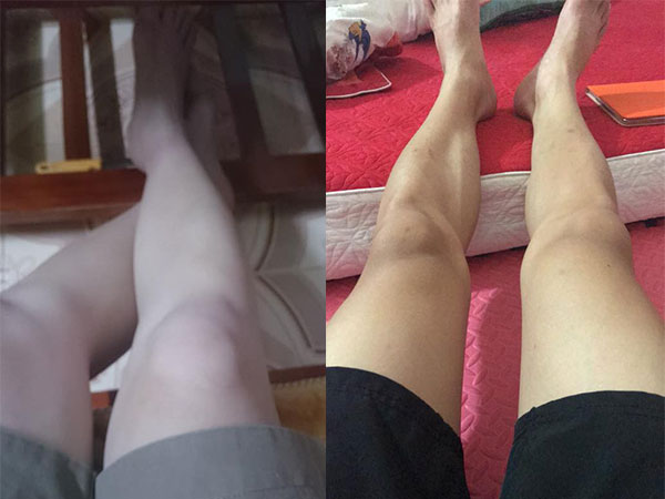 Có một nỗi khổ mang tên con trai mà chân tay không một cọng lông, láng mịn hơn cả con gái