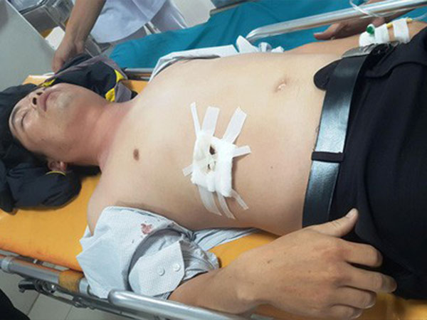 Lớp trưởng đâm thầy chủ nhiệm trọng thương vì xăm hình 'cái môi con gái'