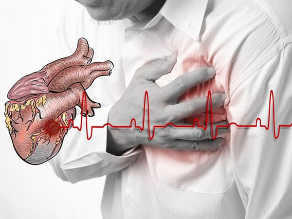 Nam y tá tự cứu sống mình trong cơn nhồi máu cơ tim