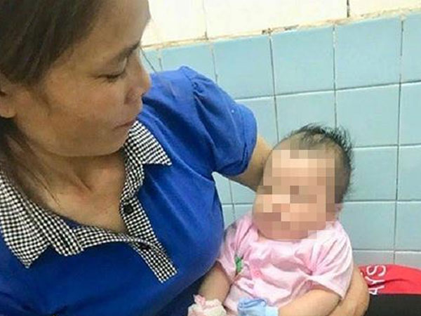 Bé trai hai tháng tuổi bị chó cắn khi đang ngủ