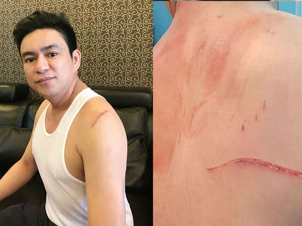 Bắt nhóm giang hồ truy sát bác sĩ Chiêm Quốc Thái ở trung tâm TP.HCM