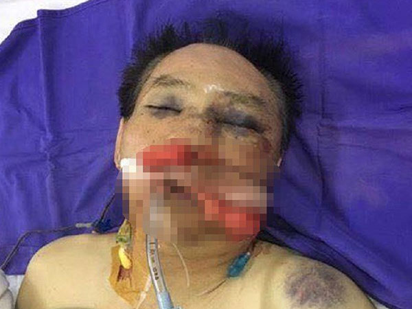 Nguyên đại tá công an đánh vợ chồng anh trai giập phổi