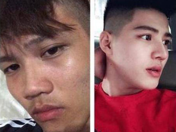 Bị người yêu bỏ rơi vì xấu xí, chàng trai 'lột xác' thành hot boy
