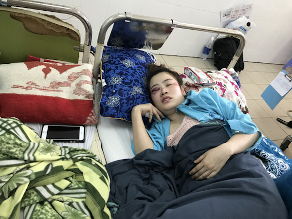 Nạn nhân bị đánh trong quán bánh xèo nộp đơn bãi nại