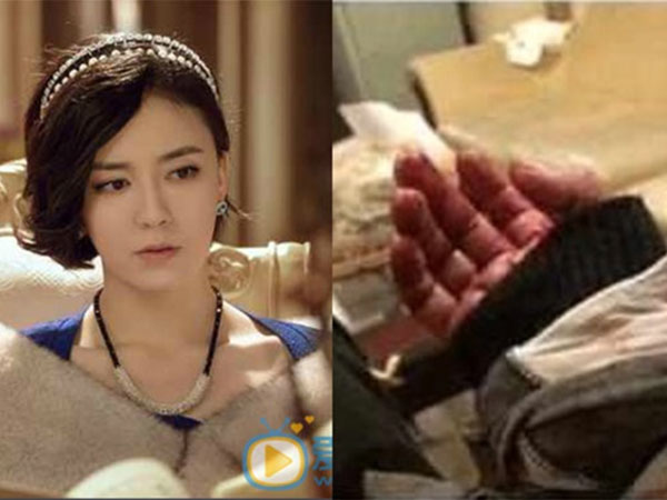 Sao nữ 'Tiếu ngạo giang hồ' cứa cổ tay tự sát vì quy tắc ngầm showbiz?
