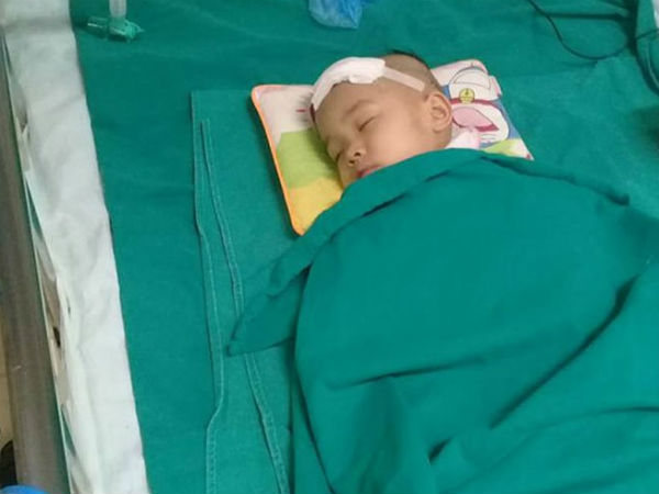 Hà Nội: Bé gái hơn 3 tuổi đau đớn trải qua 2 lần phẫu thuật trị xạ u não