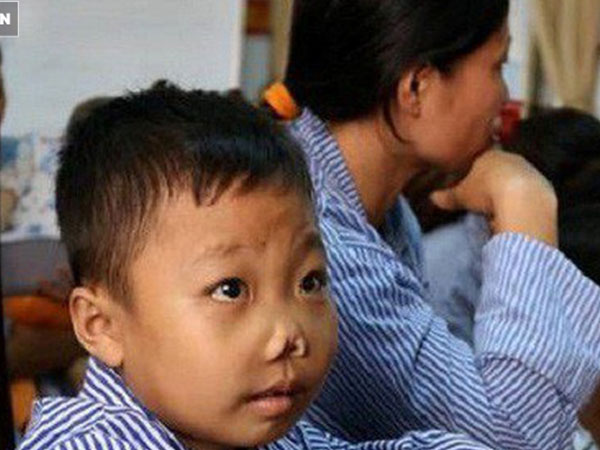 12 triệu người Việt mang gen căn bệnh phải điều trị cả đời, tốn tiền tỷ: Bộ Y tế nói gì?