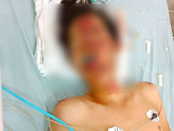 Nam thanh niên 17 tuổi nhập viện sau cuộc rượt đuổi của CSGT