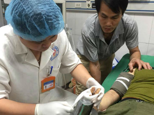 Nghệ An: Người phụ nữ mất bàn tay vì bị cuốn vào máy xay thịt