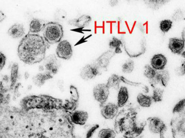 Virus cổ xưa có 'họ hàng với HIV' đột nhiên trỗi dậy