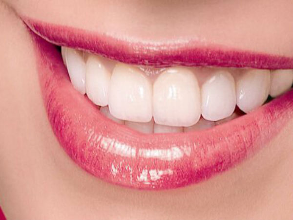Bọc răng sứ có đẹp vĩnh viễn như quảng cáo?