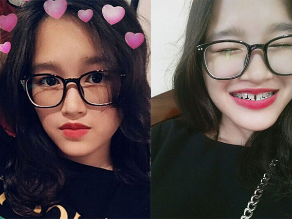 Cô bạn rất xinh cho đến khi nở nụ cười có quyết định đột phá sau 19 năm được dân tình ủng hộ 2 tay