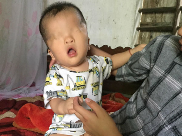 Số phận nghiệt ngã và khát vọng nhìn thấy ánh sáng của bé trai sinh ra không có đôi mắt