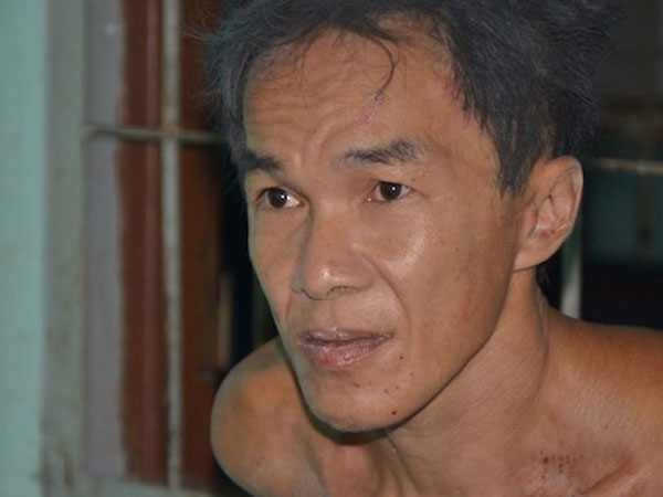 Trưng cầu giám định tâm thần thủ phạm ‘giết người phân xác’