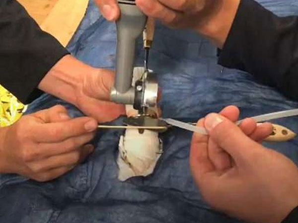 Lính cứu hỏa Đức luyện giải cứu 'của quý' kẹt trong nhẫn, cổ chai