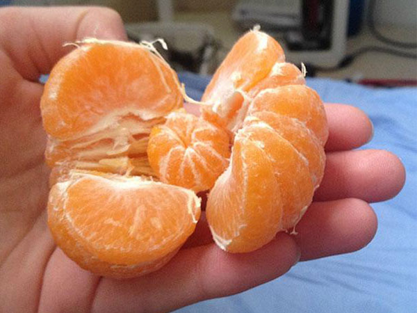 Những kẻ may mắn nhất hành tinh, đến việc ăn uống cũng không thoát kiếp 'số đỏ'