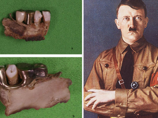 Phát hiện sự thật sốc về trùm phát xít Hitler qua bí mật trong hàm răng
