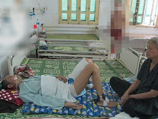 Nạn nhân vụ ô tô đâm, kéo lê ở Ô Chợ Dừa: Thoát 'tử thần', nhưng chật vật trên giường bệnh