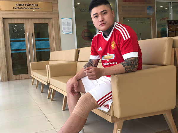 Những tai nạn kinh hoàng của sao Việt trên sân khấu