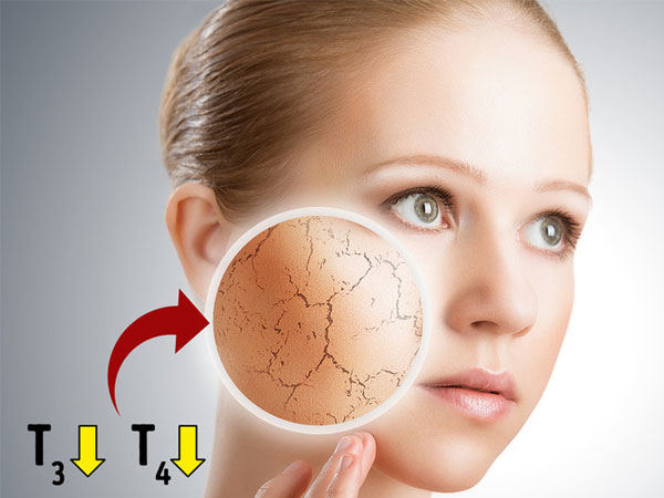 10 dấu hiệu tuyến giáp của bạn không hoạt động đúng