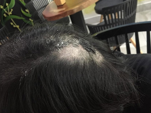 Mẹ chồng lên tiếng về nghi vấn đổ keo 502 lên đầu con dâu cũ