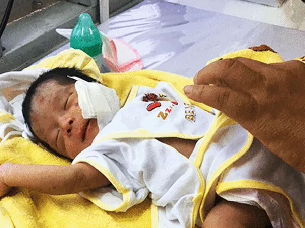 Bé trai sơ sinh ở Bình Thuận bị chôn sống, mặt phải khâu 10 mũi nguy kịch