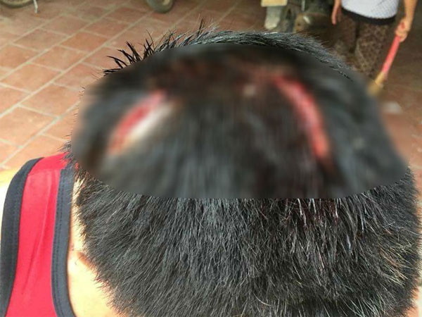 Người đàn ông bị 2 kẻ côn đồ bắt quỳ lạy, dùng hung khí đánh dã man ở Bắc Giang