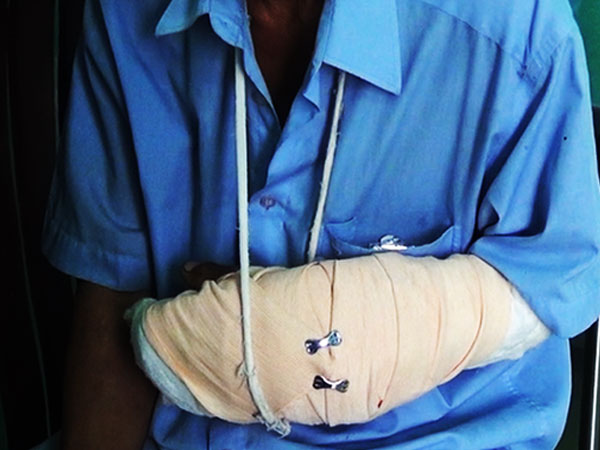 Nửa đêm, mẹ già bàng hoàng thấy con trai bị người lạ quẳng xuống trước cửa nhà, tay bị cắt gần lìa