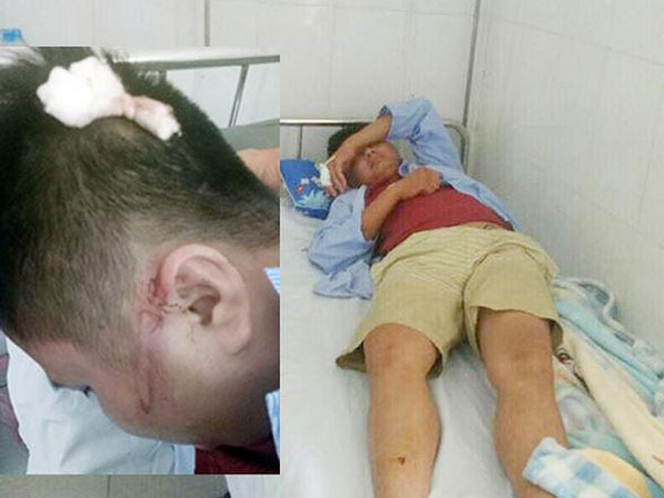 Con uống sữa không may trớ trên ô tô khách, hai người bị truy sát dã man