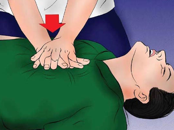 Hồi sinh một người bị ngưng tim như thế nào