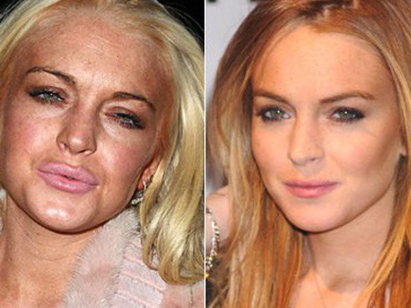 Lindsay Lohan tuổi 32: Nhan sắc già nhăn nheo trước tuổi, phải 'chạy trốn' khỏi Hollywood