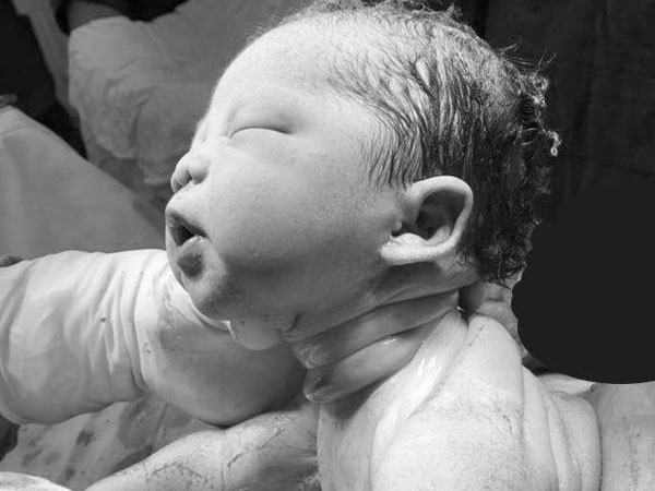 Bé Sài Gòn chào đời với dây rốn quấn chặt cổ: Các mẹ hốt hoảng, bác sĩ bảo 'chuyện thường'