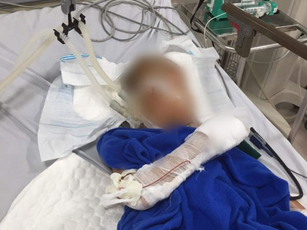 Nam thanh niên nghi ngáo đá chém bé trai 9 tuổi lún hộp sọ rồi dùng dao cứa cổ mình trước khi nhảy sông tự tử