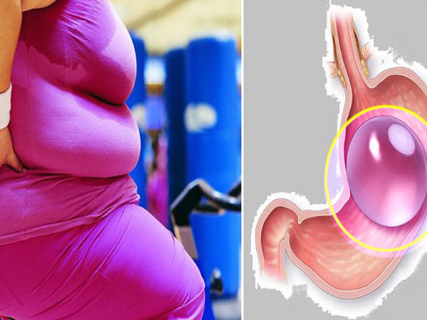 12 người đã tử vong sau khi thử cách giảm cân phổ biến này: Đây là những gì bạn nên biết để tránh