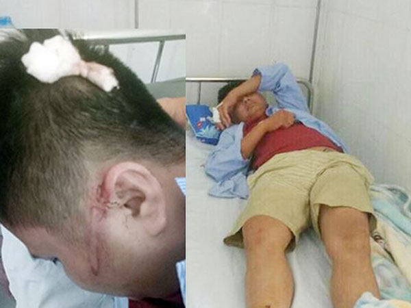 Bắt tạm giam tài xế ô tô khách đánh bất tỉnh người bố để con nôn ra xe