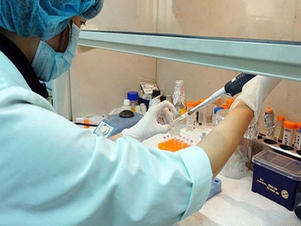 Làm gì khi nghi mình nhiễm cúm A H1N1?