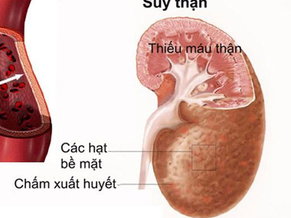 Cụ bà 'nôn thốc nôn tháo' vì ăn dứa mỗi ngày, loại quả này không phải ai cũng ăn được