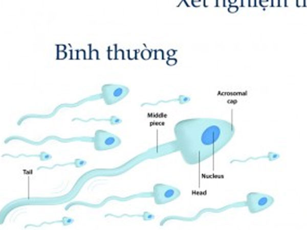 Mãn dục nam - Hiểu để ứng phó phù hợp