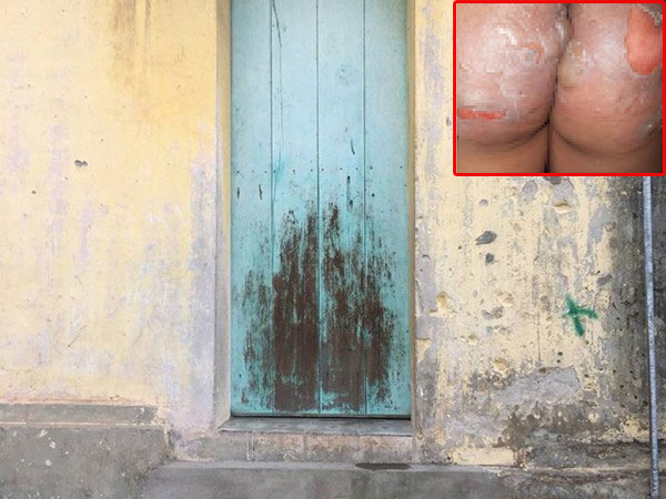 Vụ 2 cháu bé bị hắt nước gây bỏng nặng: Hàng xóm khẳng định không hề biết có trẻ ngồi ở bậc cửa
