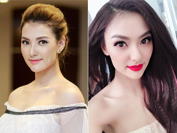 Hồng Quế nói gì trước nghi vấn gương mặt nhọn bất thường vì dao kéo?