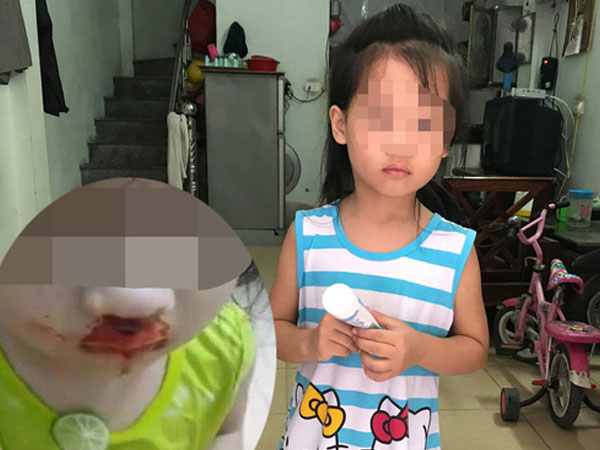 Thông tin bất ngờ vụ bé gái bị mẹ đánh, chửi phát trên facebook
