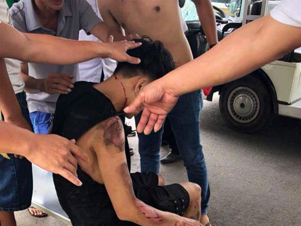 Xe điện tông du khách ở Bà Nà, 6 người bị thương