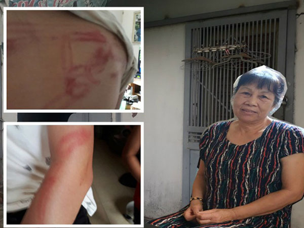 Vụ bố dùng tuýp sắt đánh con 'như kẻ thù': Người mẹ lên tiếng