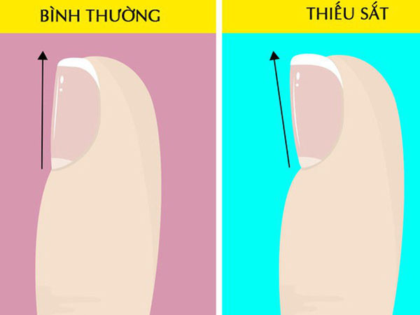 Hãy nhìn xuống đôi chân mình và xem nó đang cảnh báo bạn những vấn đề gì về sức khỏe