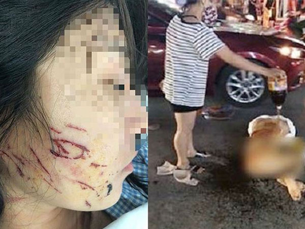 Ba phụ nữ bị khởi tố vì lột đồ đổ nước mắm vào người cô gái trẻ