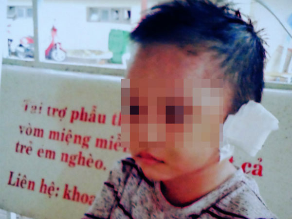 Bà ngoại bé 3 tuổi nghi bị mẹ ruột và cha dượng bạo hành ở Bình Dương: 'Tôi sợ nó điên lên lại đánh chết thằng bé'
