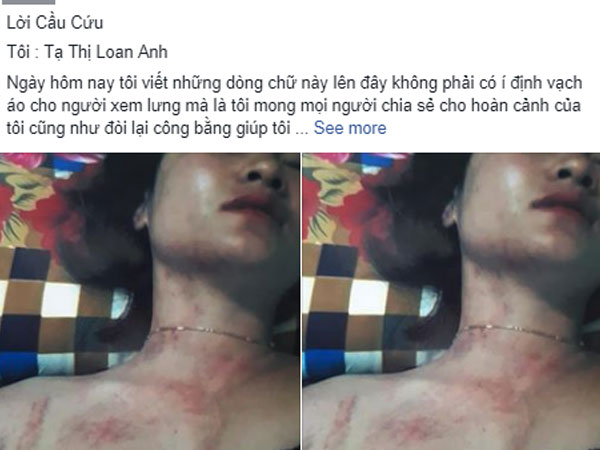 Tình tiết bất ngờ vụ vợ lên FB tố bị bạo hành: Người chồng khẳng định tất cả chỉ là chiêu trò của vợ