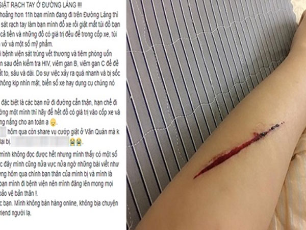 Tự dùng dao lam rạch tay, dựng chuyện bị cướp ở đường Láng