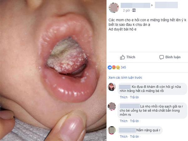 Con có bệnh trong miệng, đau không chịu ăn, mẹ bị mắng tới tấp vì không đưa đi khám còn lên Facebook hỏi 'các mẹ ơi'